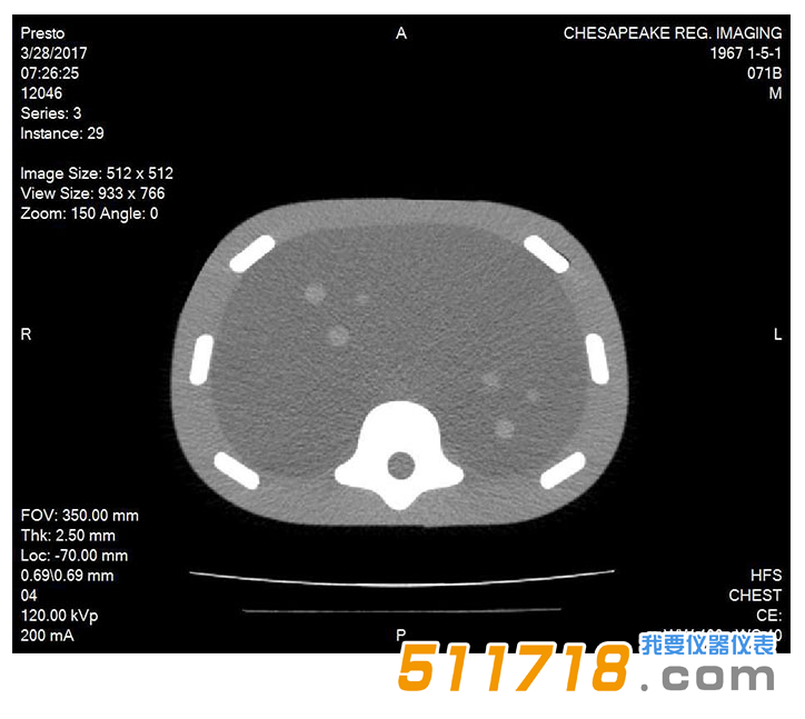 美国CIRS 071B图像引导腹部活组织检查模体2.png