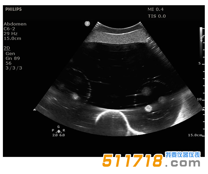 美国CIRS 071B图像引导腹部活组织检查模体3.png