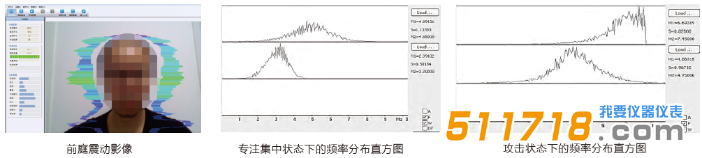 JT3010 心理健康状态检测.png