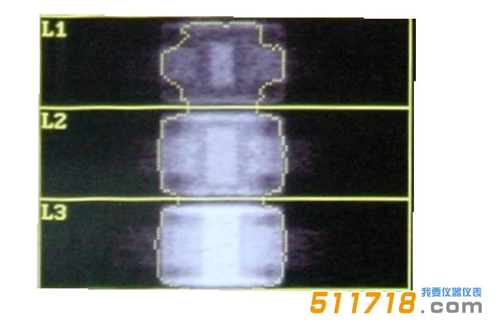 QRM-ESP 的 DXA 扫描（说明见以上文字） (1).png