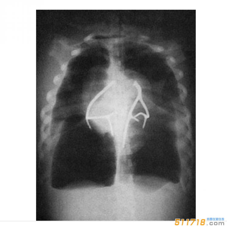 美國CIRS 602三維軀干模體
